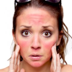 Body Parts That are Most Vulnerable To Getting Sun Damage